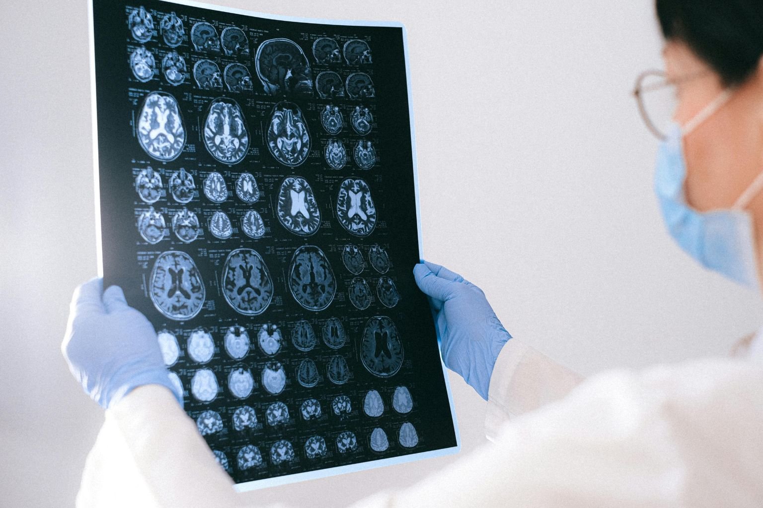 traumatic brain injury care